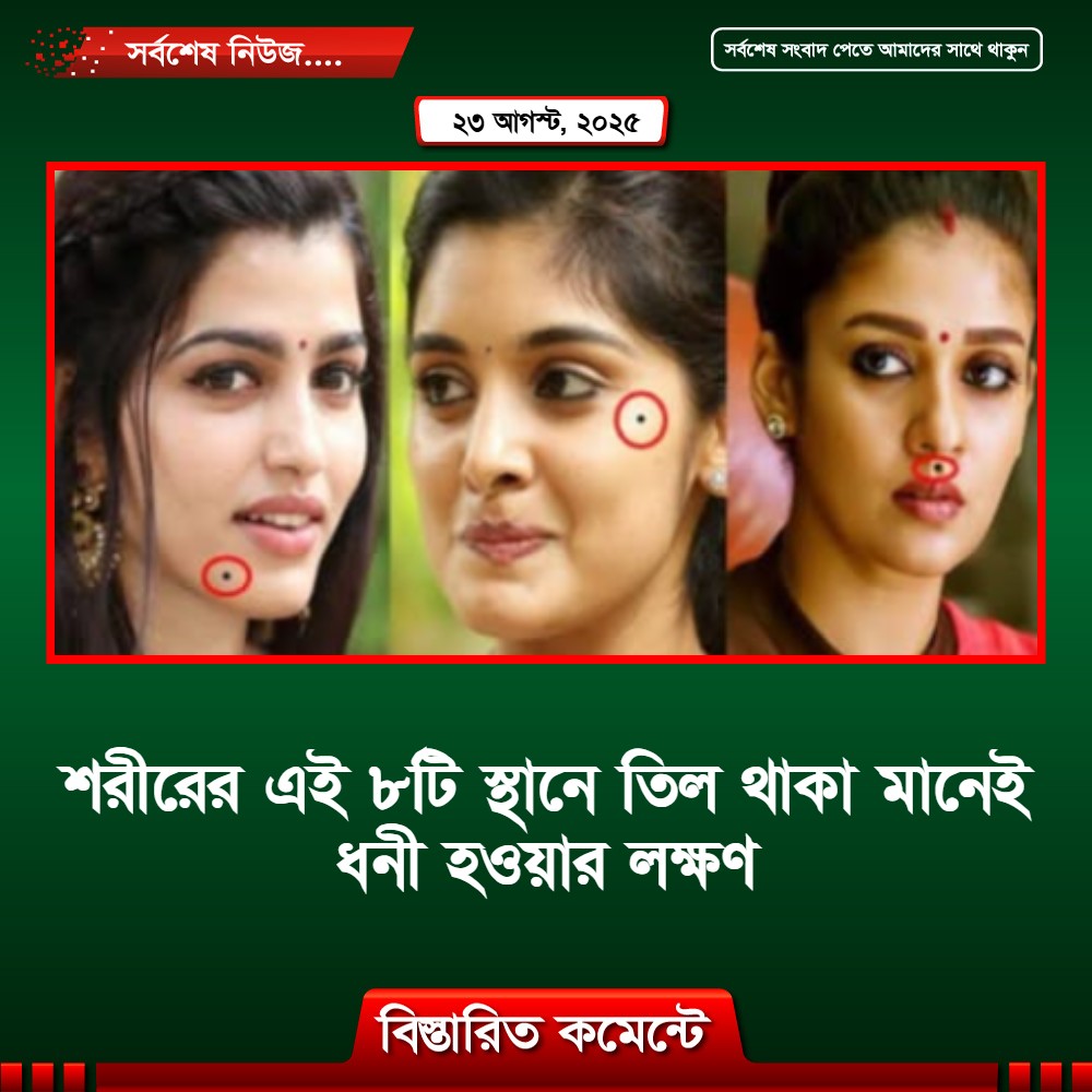 শরীরের এই ৮টি স্থানে তিল থাকা মানেই ধনী হওয়ার লক্ষণ