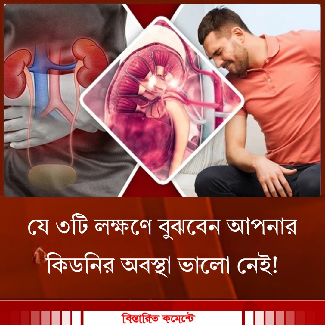 যে ৩টি লক্ষণে বুঝবেন আপনার কিডনির অবস্থা ভালো নেই!