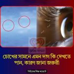 চো’খের সামনে এমন দাগ কি দেখতে পান? কারন জানা জ’রুরী