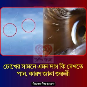 চো’খের সামনে এমন দাগ কি দেখতে পান? কারন জানা জ’রুরী