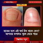 হাতের নখে এই অর্ধ চাঁদ থাকে কেন জানেন? জানুন আপনার কপালও খুলে যেতে পারে