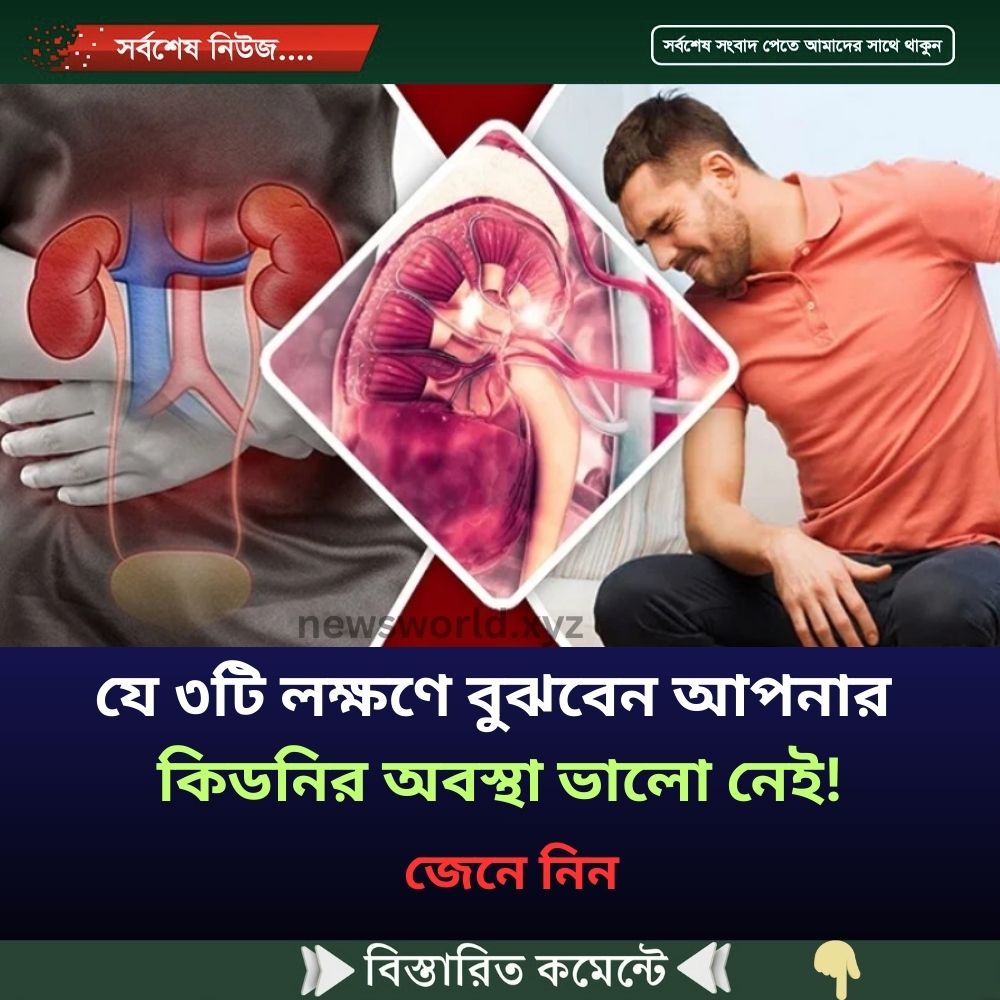 যে ৩টি লক্ষণে বুঝবেন আপনার কিডনির অবস্থা ভালো নেই!