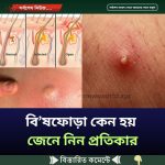 বিষফোঁড়া কেন হয়, জেনে নিন প্রতিকার