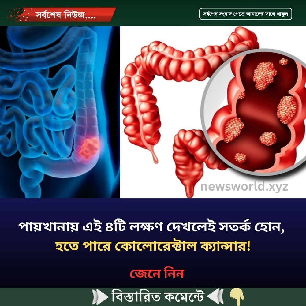 পায়’খানায় এই ৪টি লক্ষণ দেখলেই সতর্ক হোন, হতে পারে কোলো’রেক্টাল ক্যা’ন্সার!