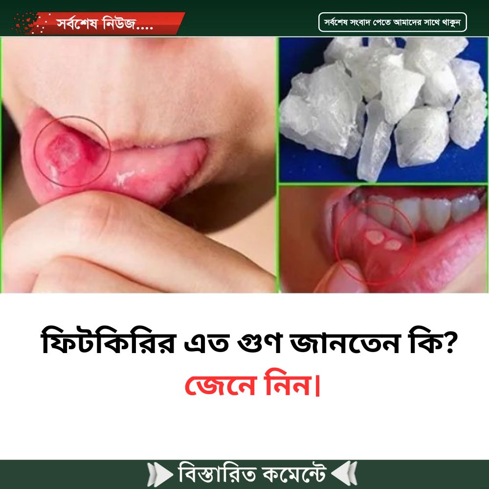 ফিটকিরির এত গুণ জানতেন কি? জেনে নিন।