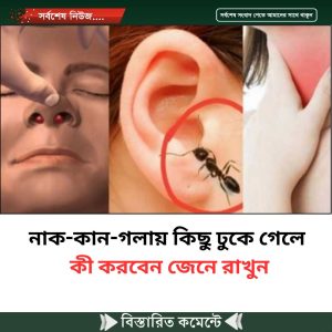 নাক-কান-গলায় কিছু ঢুকে গেলে কী করবেন জেনে রাখুন