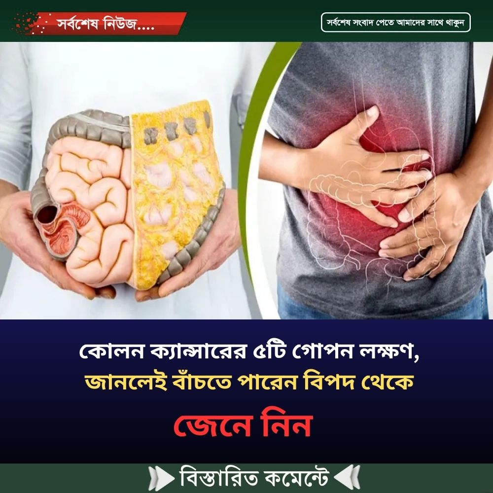কোলন ক্যান্সারের ৫টি গোপন লক্ষণ, জানলেই বাঁচতে পারেন বিপদ থেকে