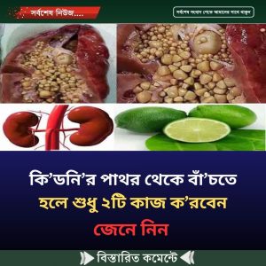 কি’ডনি’র পাথর থেকে বাঁ’চতে হলে শুধু ২টি কাজ ক’রবেন