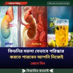 কিডনির ময়লা যেভা’বে পরিস্কার করতে পারবেন আপ’নি নি’জেই