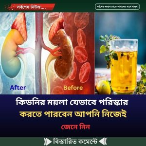 কিডনির ময়লা যেভা’বে পরিস্কার করতে পারবেন আপ’নি নি’জেই