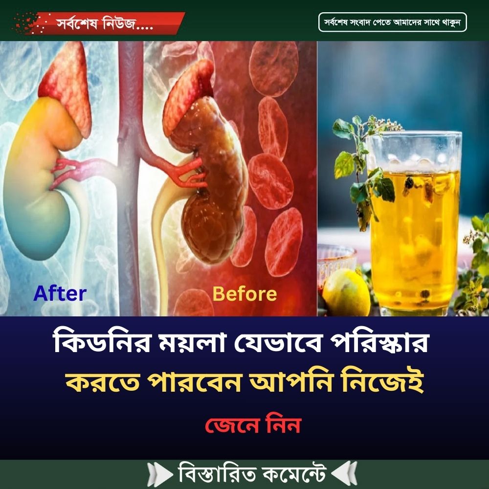 কিডনির ময়লা যেভা’বে পরিস্কার করতে পারবেন আপ’নি নি’জেই