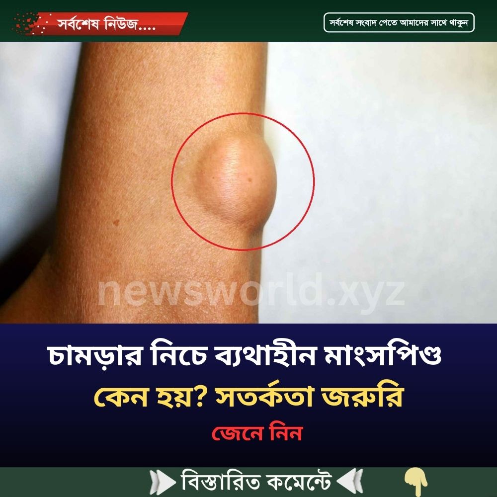 চামড়ার নিচে ব্যথাহীন মাংসপিণ্ড কেন হয়? সতর্কতা জরুরি