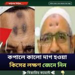কপালে কালো দাগ হওয়া কিসের লক্ষণ