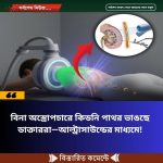 বিনা অস্ত্রোপচারে কিডনি পাথর ভাঙছে ডাক্তাররা—আল্ট্রাসাউন্ডের মাধ্যমে!