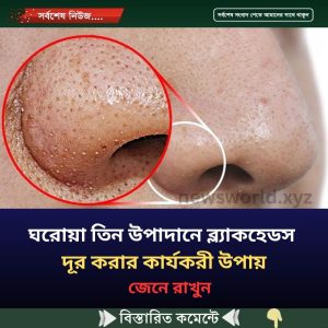 ঘরোয়া কোন উপাদান ব্ল্যাকহেডস দূর করার কার্যকরী উপায়