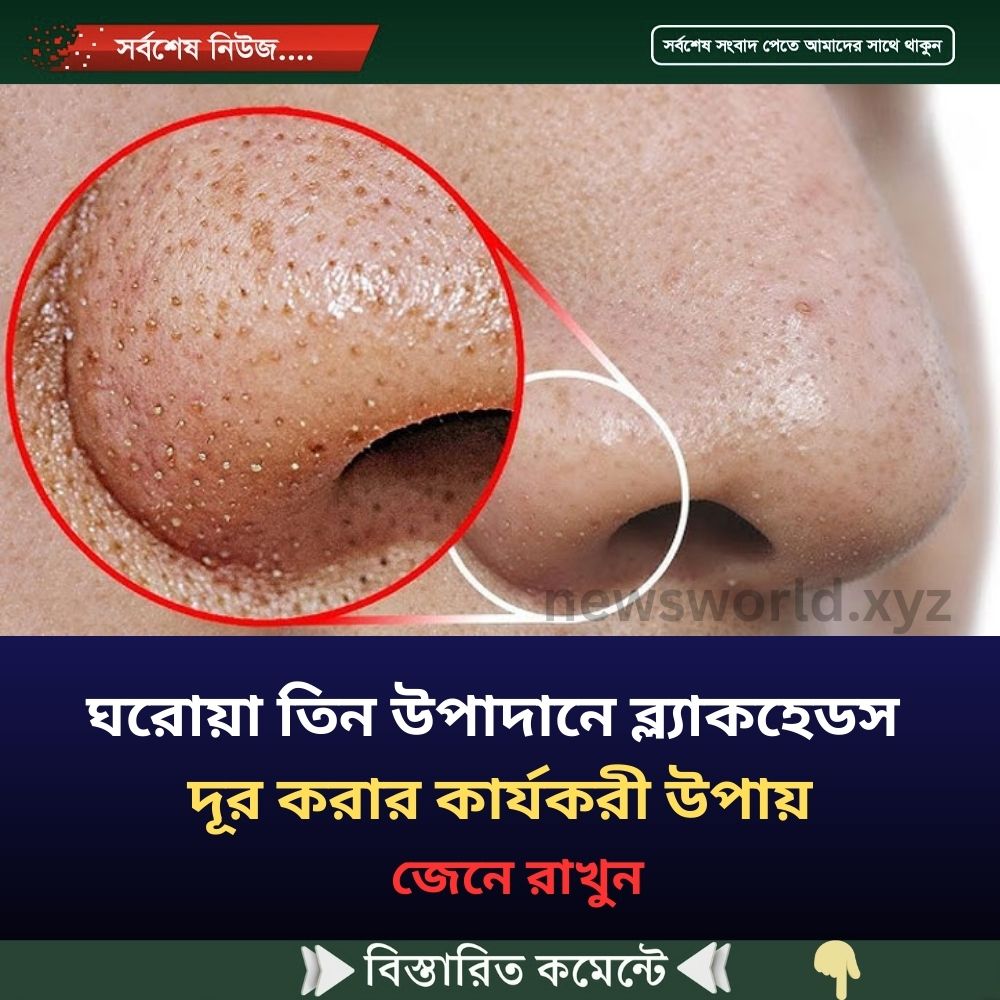ঘরোয়া কোন উপাদান ব্ল্যাকহেডস দূর করার কার্যকরী উপায়