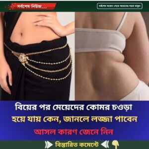 বিয়ের পর মেয়েদের কোমর চওড়া হয়ে যায় কেন, জানলে লজ্জা পাবেন
