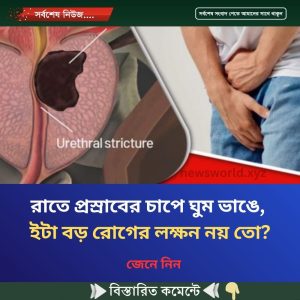 রাতে প্রস্রাবের চাপে ঘুম ভাঙে, ইটা বড় রোগের লক্ষন নয় তো?