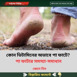 কোন ভিটামিনের অভাবে পা ফাটে? পা ফাটার সমস্যা-সমাধান