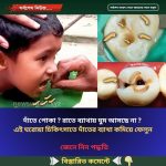 দাঁতে পোকা ? রাতে ব্যাথায় ঘুম আসছে না ? এই ঘরোয়া চিকিৎসাতে দাঁতের ব্যাথা কমিয়ে ফেলুন
