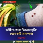আঁচিল থেকে চিরতরে মুক্তি দেবে কচি আমপাতা
