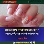 নখে সাদা দাগ হয় কেন, অনেকেই এর কারণ জানেন না