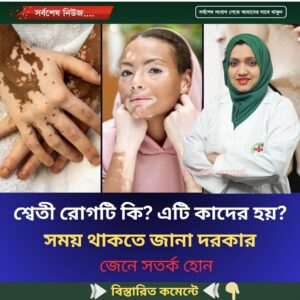 শ্বেতী রোগটি কি? এটি কাদের হয়, সময় থাকতে জানা দরকার