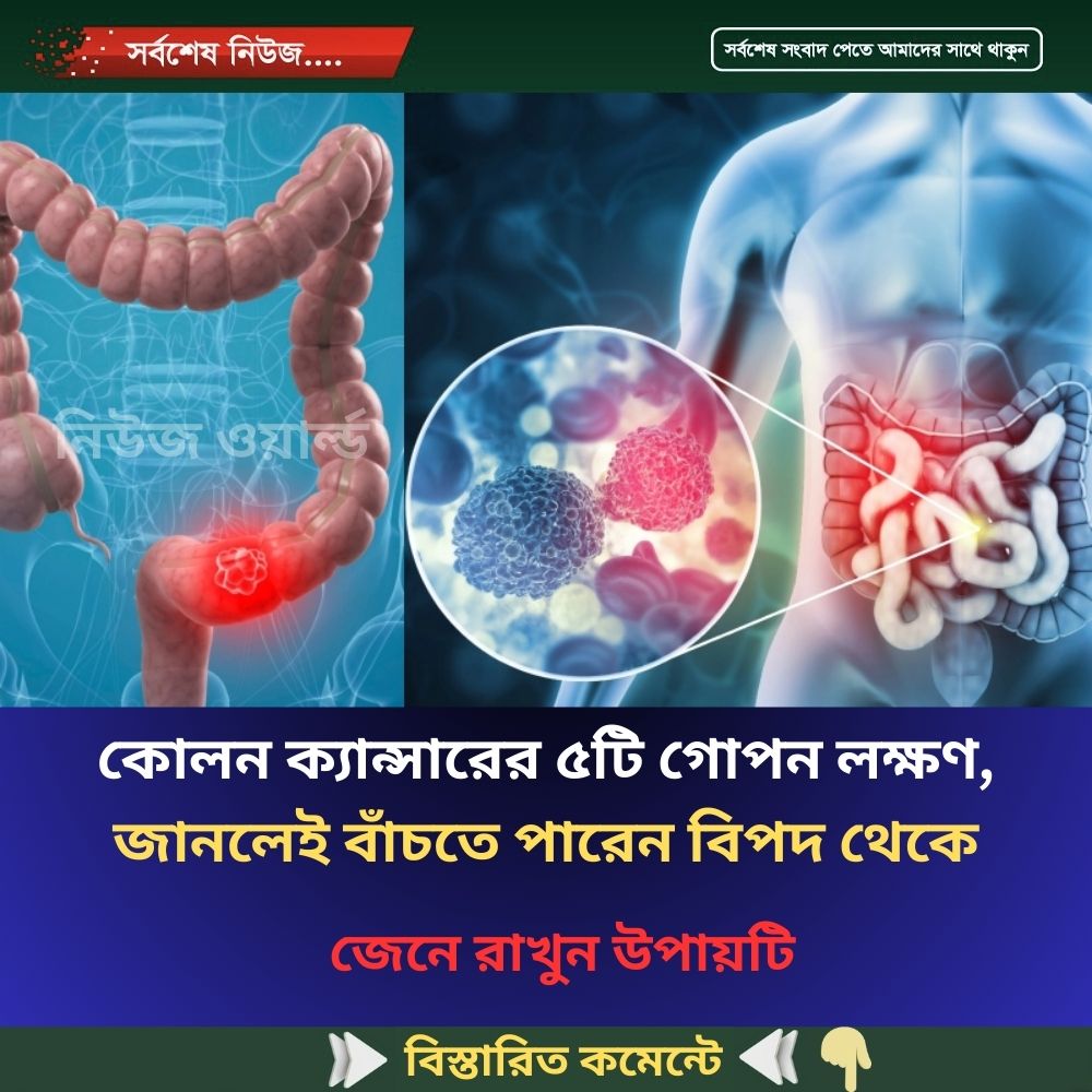 কোলন ক্যান্সারের ৫টি গোপন লক্ষণ, জানলেই বাঁচতে পারেন বিপদ থেকে
