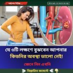 যে ৩টি লক্ষণে বুঝবেন আপনার কিডনির অবস্থা ভালো নেই!