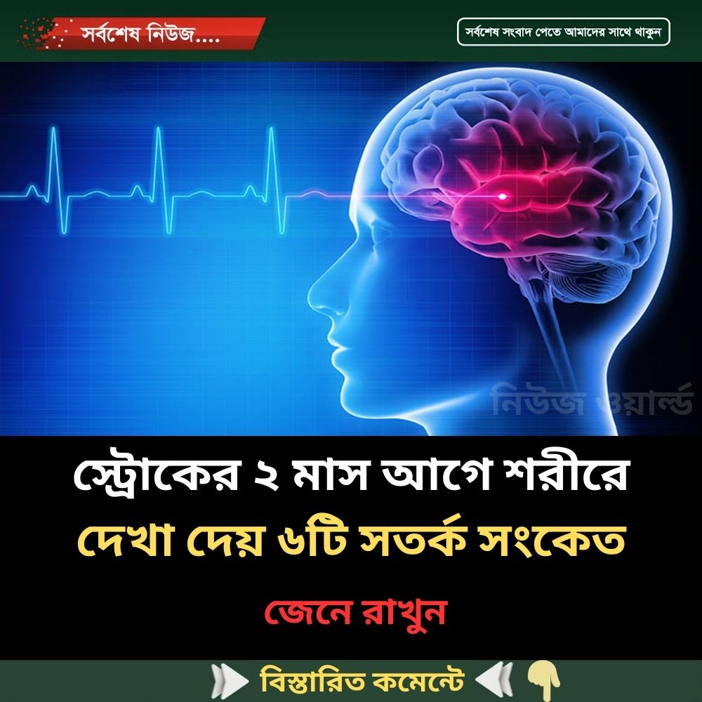 স্ট্রোকের ২ মাস আগে শরীরে দেখা দেয় ৬টি সতর্ক সংকেত