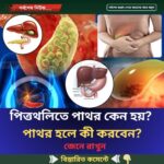 পিত্তথলিতে পাথর কেন হয়? পাথর হলে কী করবেন?
