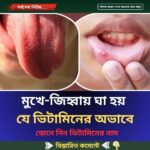 মুখে-জিহ্বায় ঘা হয় যে ভিটামিনের অভাবে