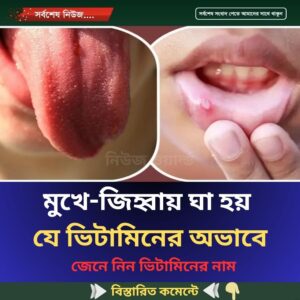 মুখে-জিহ্বায় ঘা হয় যে ভিটামিনের অভাবে