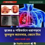 ত্বকের ৫ পরিবর্তনে ধরা পড়বে ফুসফুস ক্যা’ন’সা’র, জেনে নিন