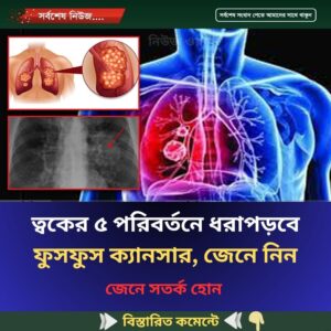 ত্বকের ৫ পরিবর্তনে ধরা পড়বে ফুসফুস ক্যা’ন’সা’র, জেনে নিন