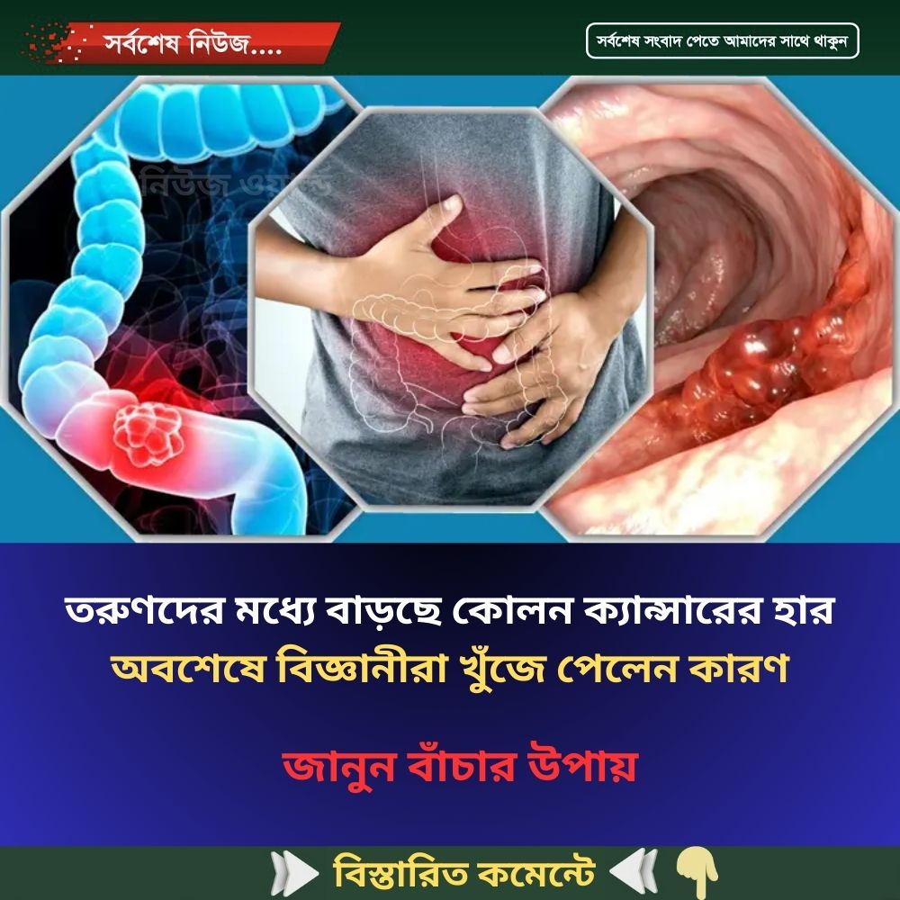 তরুণদের মধ্যে বাড়ছে কোলন ক্যান্সারের হার, অবশেষে বিজ্ঞানীরা খুঁজে পেলেন কারণ