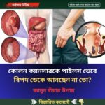 কোলন ক্যানসারকে পাইলস ভেবে বিপদ ডেকে আনছেন না তো?
