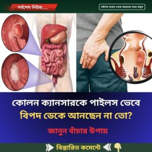 কোলন ক্যানসারকে পাইলস ভেবে বিপদ ডেকে আনছেন না তো?