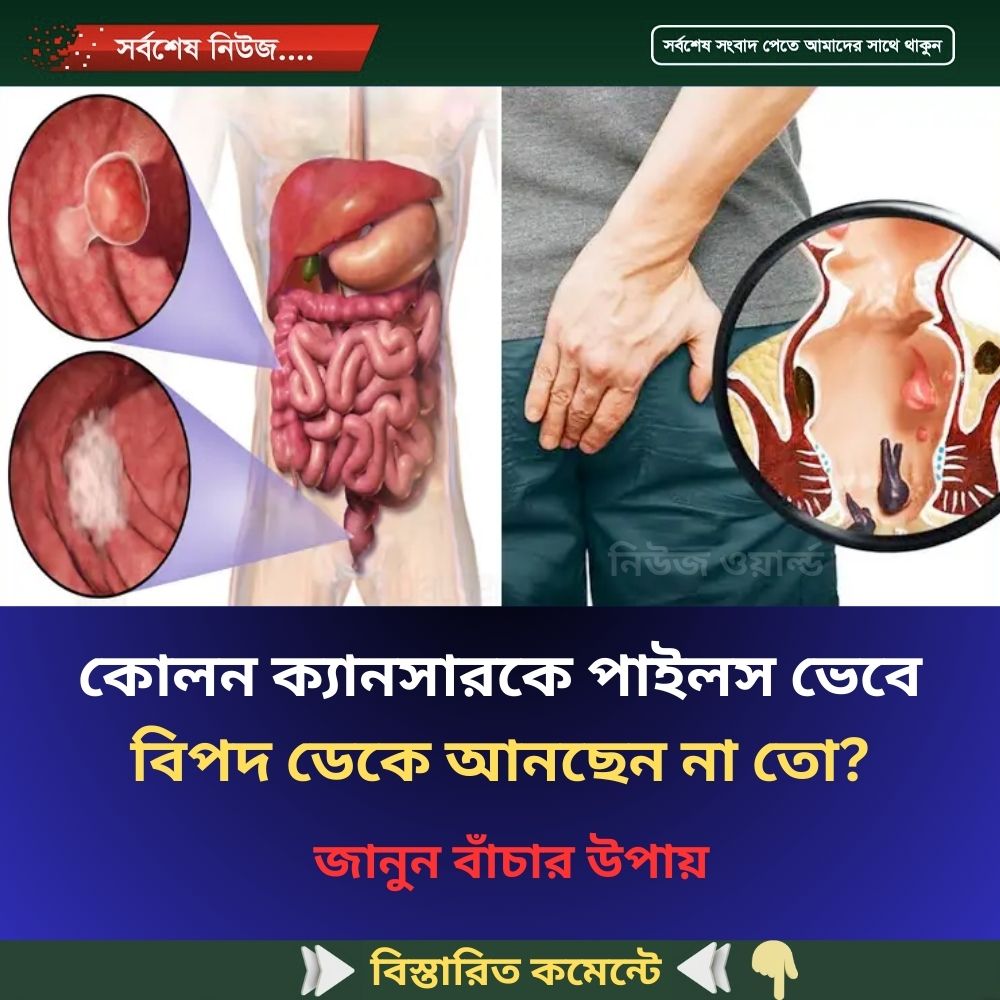 কোলন ক্যানসারকে পাইলস ভেবে বিপদ ডেকে আনছেন না তো?