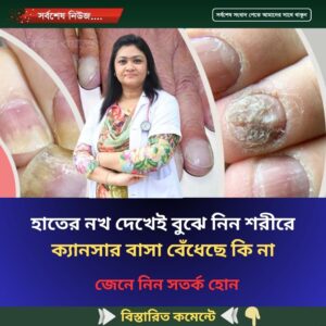 হাতের নখ দেখেই বুঝে নিন শরীরে ক্যানসার বাসা বেঁধেছে কি না