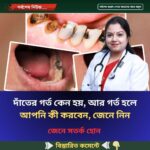 দাঁ’তের গ’র্ত কেন হয়, আর গ’র্ত হলে আপনি কী করবেন জেনে নিন