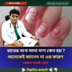 হাতের নখে সাদা দাগ কেন হয় ? অনেকেই জানেন না এর কারণ