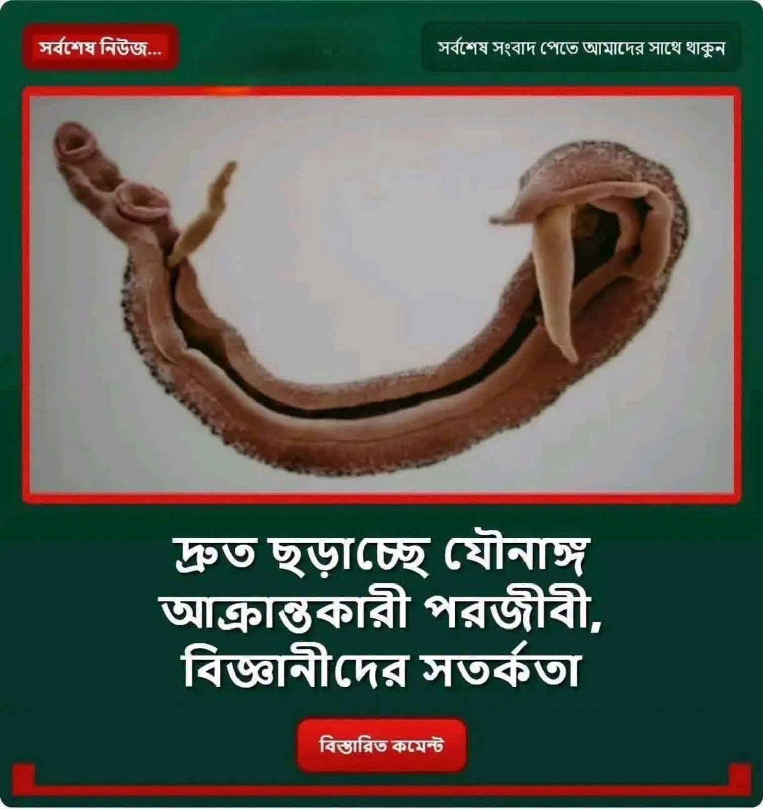 ব্রেকিং নিউজ দ্রু’ত ছড়াচ্ছে যৌ”নাঙ্গ…see more